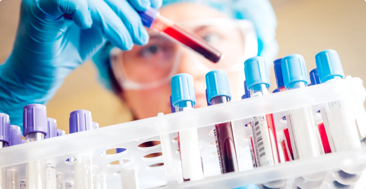 vedkyňa v labáku vyhodnocuje testy na pohlavné choroby z krvi 