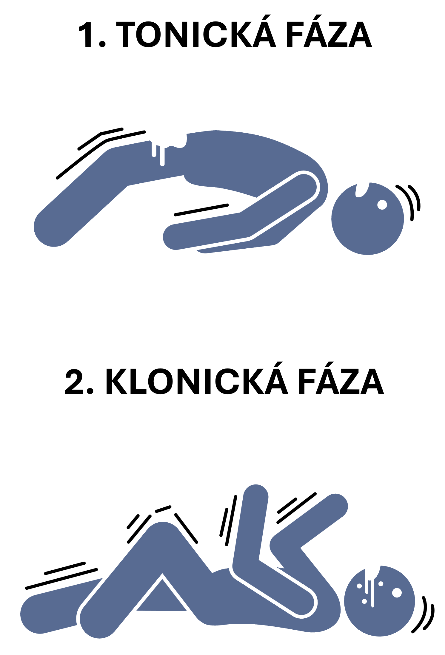 tonicko-klonický záchvat (grand mal)